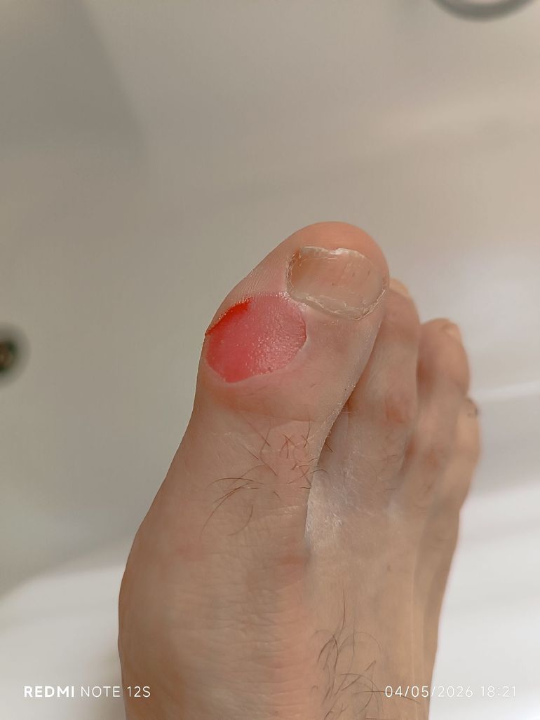 Slide 6