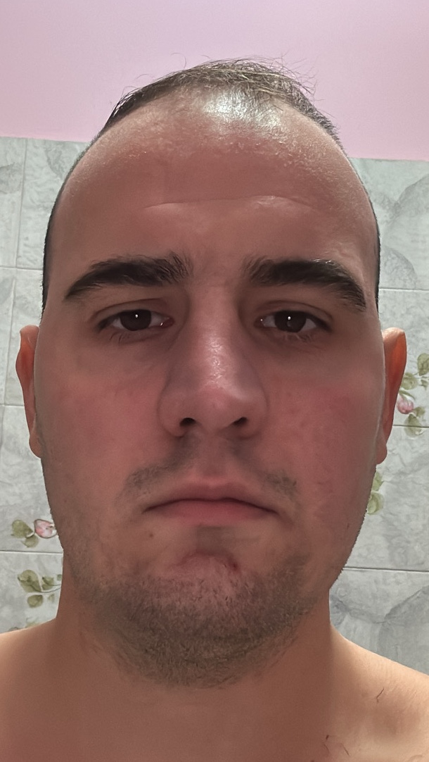 RN