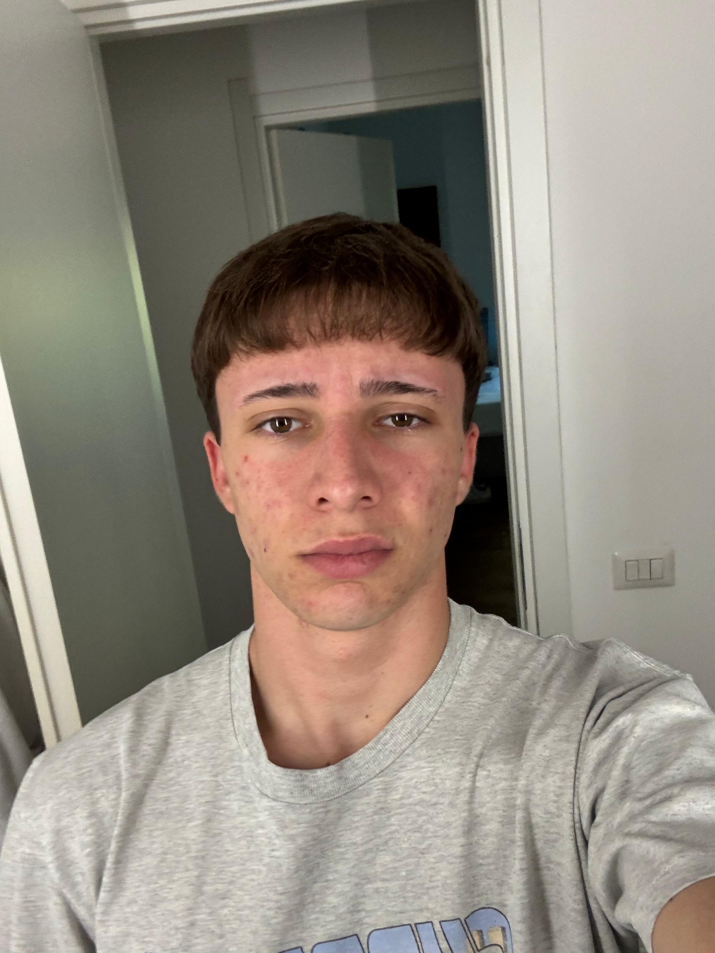 NA